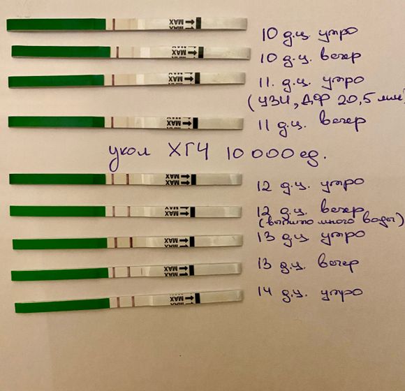 Тест на Овуляцию после укола ХГЧ 💉
