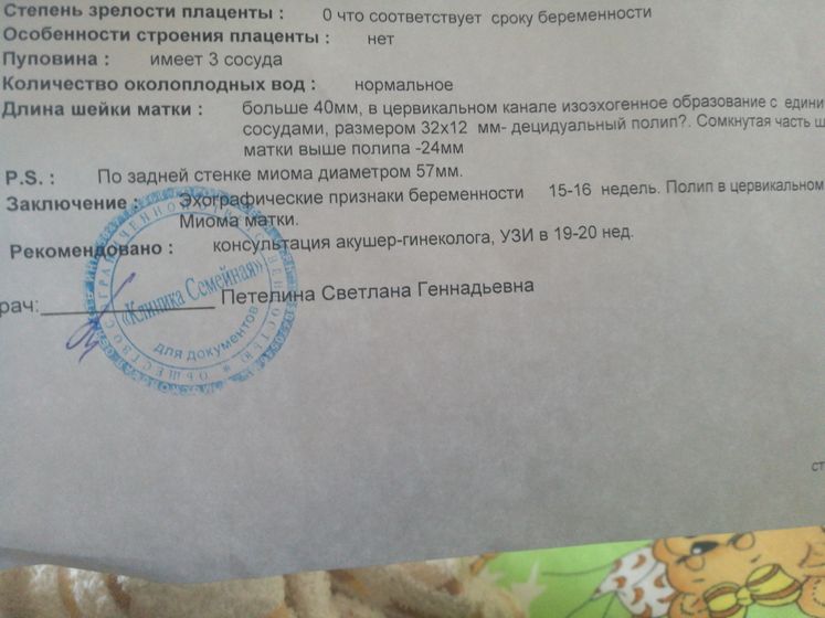 Полип и миома при беременности