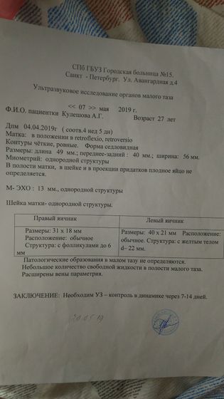 Узи результат.