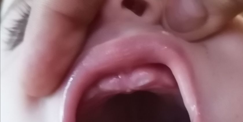 Кривые зубы😩😩😩😩😩😩😩😩вот почему они