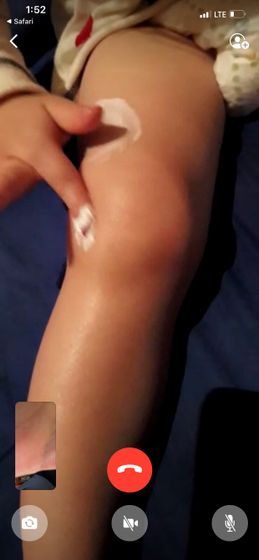 Ушиб? Артрит? Срочно подскажите😭😭😭🥴