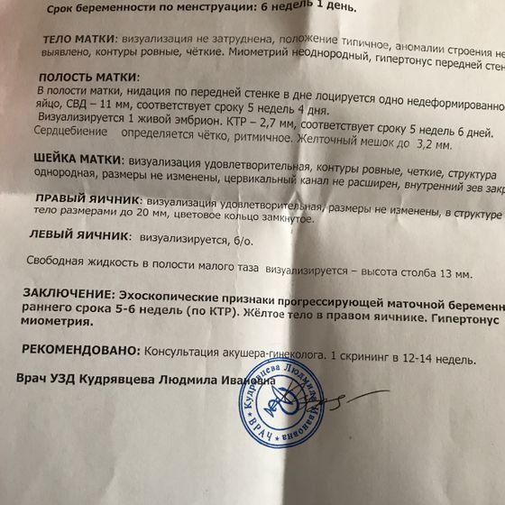 Узи
