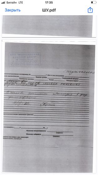 Результат Пайпель