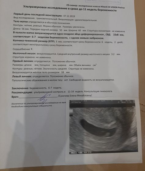 Не слышно сердцебиениятолько видно..((( Срок 6недель