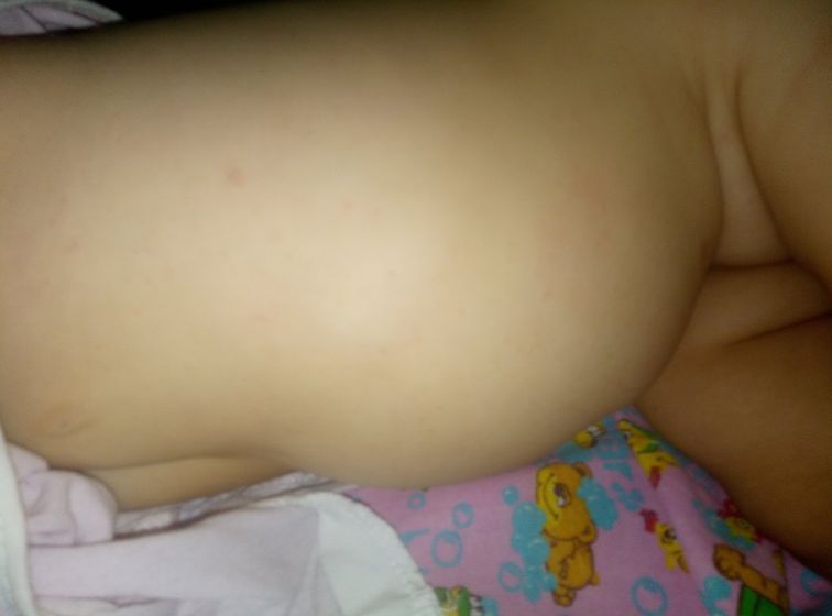 Может ли быть аллергия