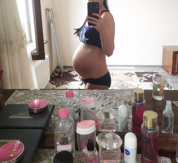 Живот на 31неделе
