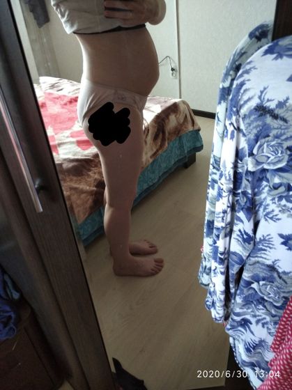 Живот после родов Девочки,
