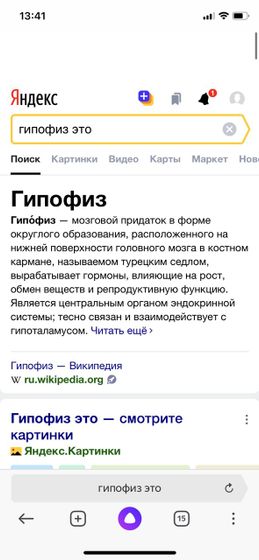 Гипофиз мрт