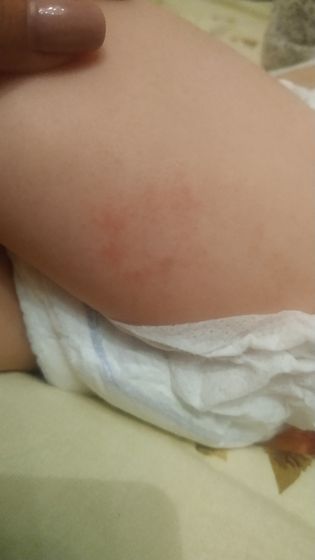 Девочки плиз что это??