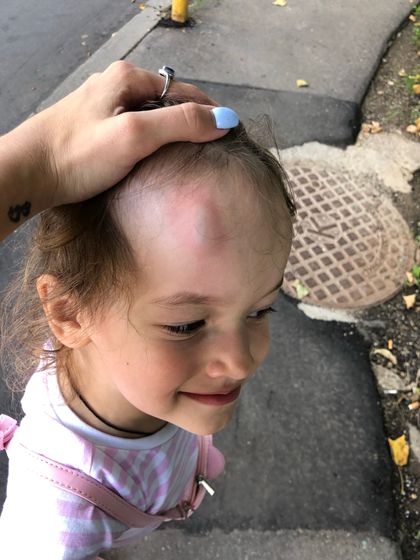 Чем помазать теперь?