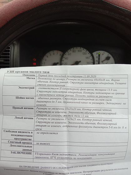 Узи.