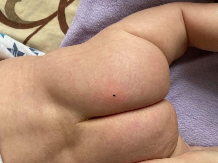 У сына знакомой вышло такое . У кого такое было или что это ?