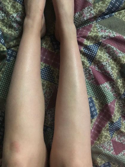 Тромбы?🤷🏻♀️