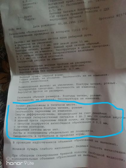 Интересно получается ? Сходила