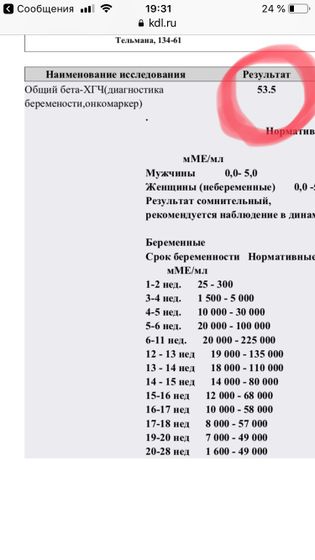 Хгч