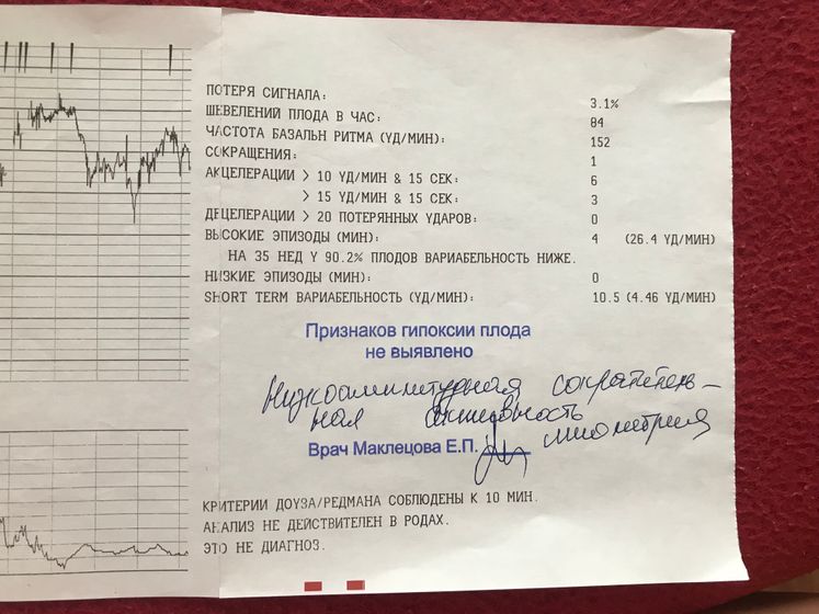 Паника! КТГ в 35 недель