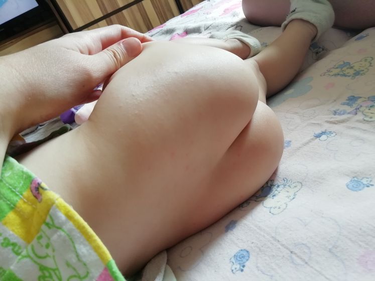 Сыпь