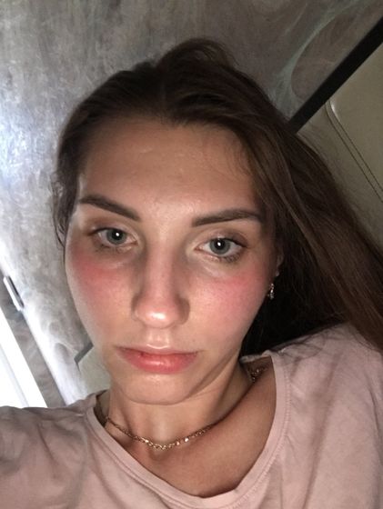 РОЗАЦЕА !!!! 🆘🆘🆘🆘🆘🆘🆘🆘🆘🆘🆘Девочки подскажите у кого может было ?