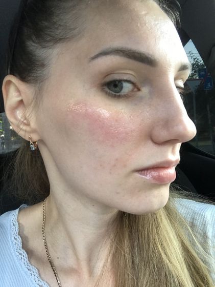 РОЗАЦЕА !!!! 🆘🆘🆘🆘🆘🆘🆘🆘🆘🆘🆘Девочки подскажите у кого может было ?