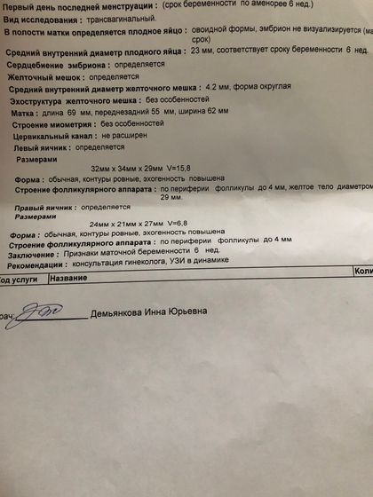 Узи переделала