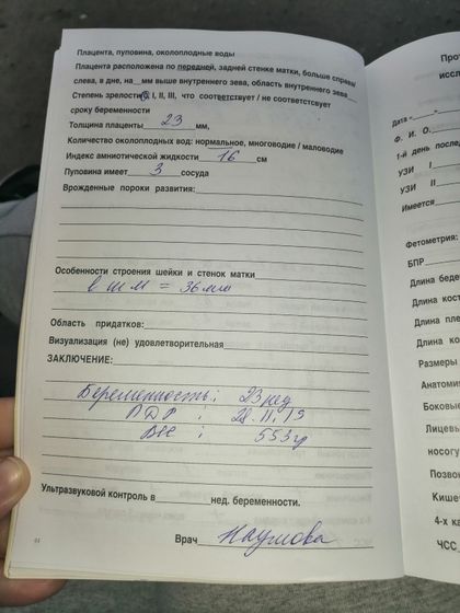 Сегодня сделала 2 скрининг,