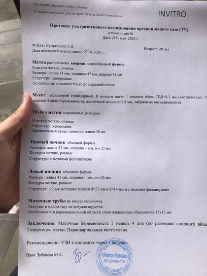Узи