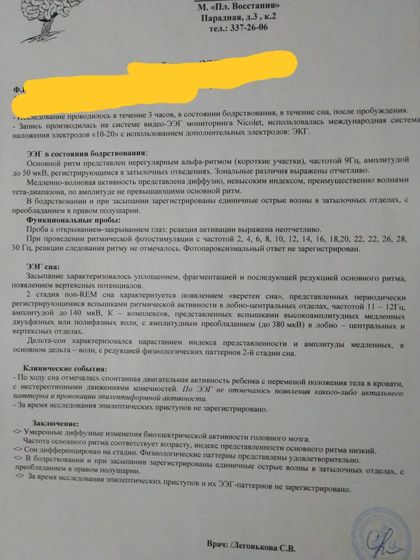 Ээг.