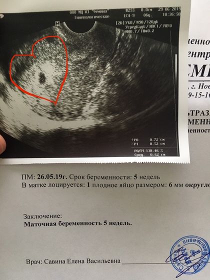 Нам 5 недель ?