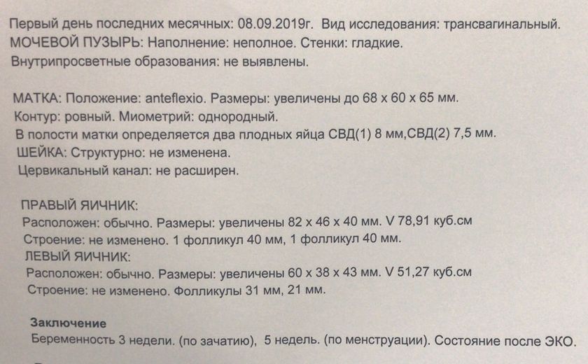 Эко - 21дпп!