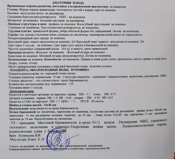 Выписали 23 числа пошла