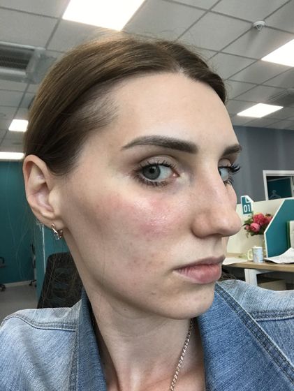 РОЗАЦЕА !!!! 🆘🆘🆘🆘🆘🆘🆘🆘🆘🆘🆘Девочки подскажите у кого может было ?