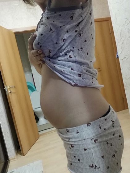Послеродовой живот