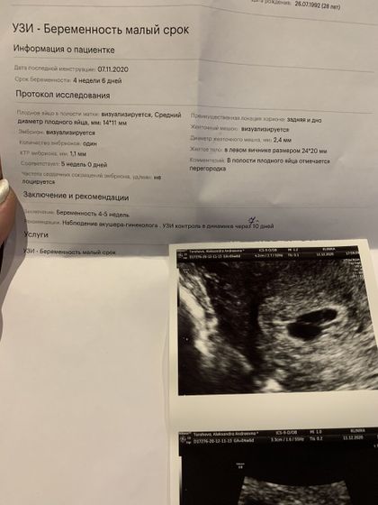 Узи я в шоке