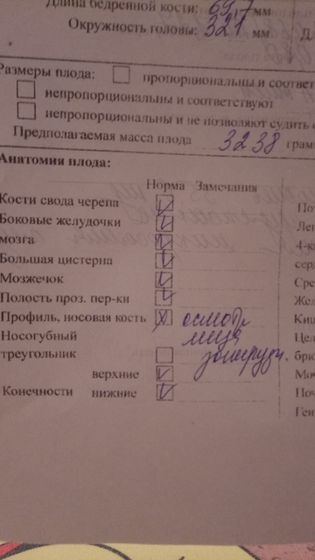Девочки у кого небольшое