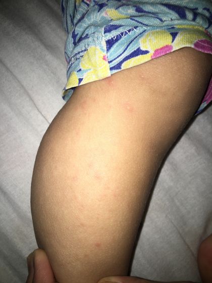 У кого так было?Скажите
