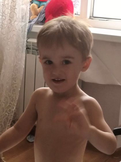 Реакция на прививку?