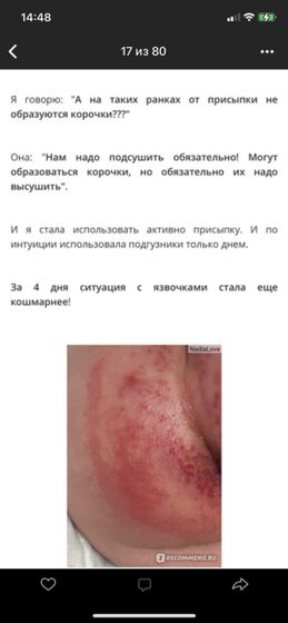 Попка (