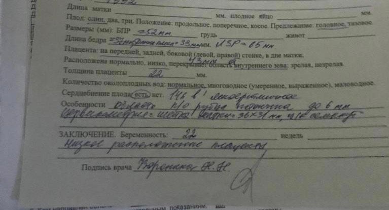 Девочки заловка Поступила в