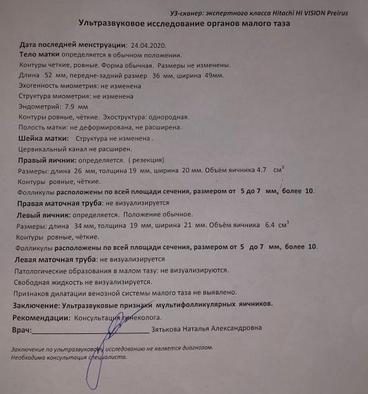 С приёма новости ?
