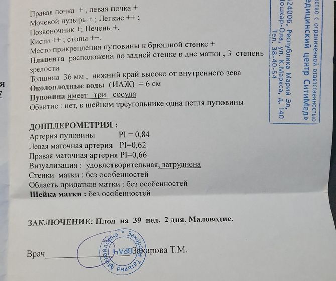 Узи в 39+2,маловодие. Завтра ложусь в предродовое=((