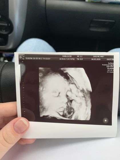 Сегодня 32 недели ❤️