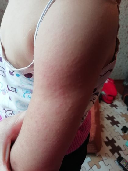 Девочки на что похоже?