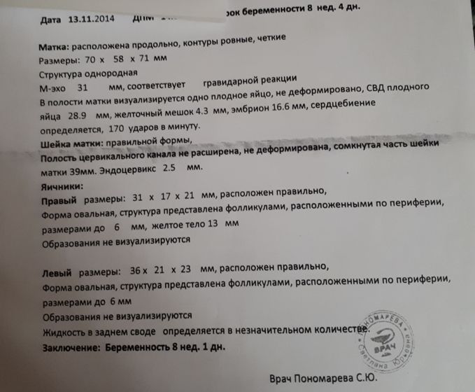 История моей первой беременности ( часть 2)