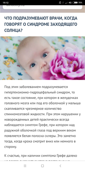 Синдром заходящего солнца