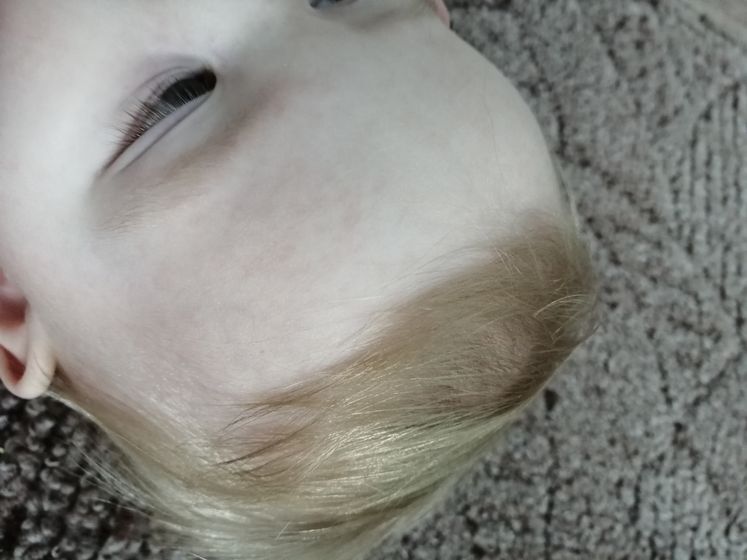 🆘❗❗❗ Аллергия???
