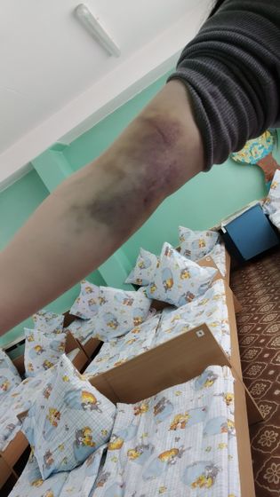 Взяли кровь из вены в 