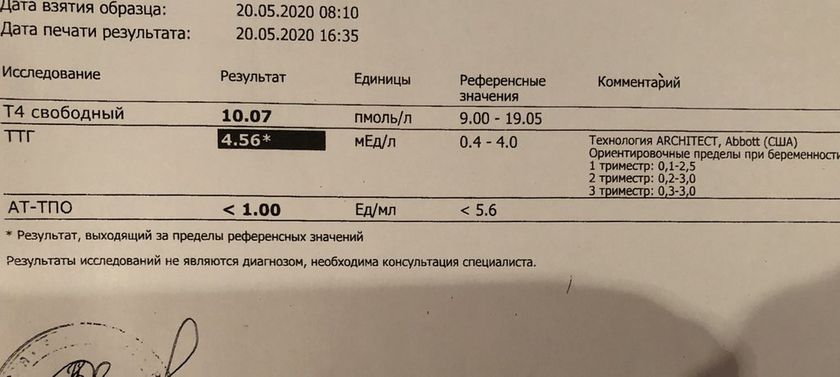 Щитовидка