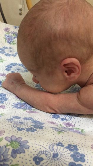 Выносить и родить после диагноза «внематочная»/ разрыв матки