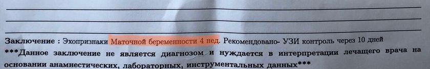 Сходила на узи ,
