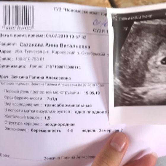 Была сегодня первый раз